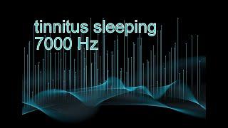 Tinnitus Sleeping, vence al tinnitus con terapia de sonido de ruido blanco para acúfenos - HD