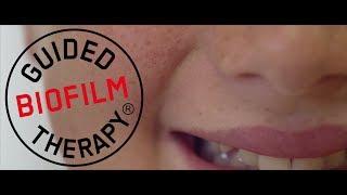 Professional teeth cleaning for Children (Guided Biofilm Therapy)