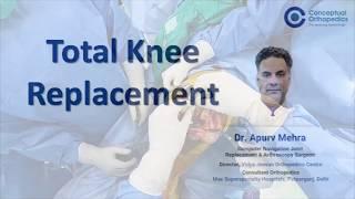 TKR by Dr Apurv Mehra Joint Replacement Surgeon (OT Recording)