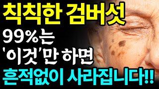 집에서 검버섯 없애는 방법 3가지 총정리! 피부과에 헛돈 쓰지마세요! 따라만 하면 검버섯, 기미 번지지 않고 싹 다 사라집니다!