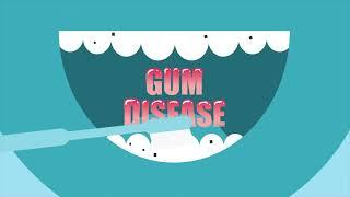 Prevent Gum Disease with Listerine® Today!