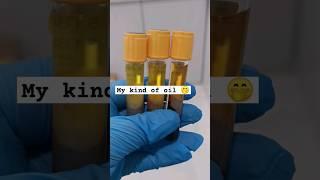 blood serum #medtechlife #cls #mls #laboratory #bloodgrouping #bloodtest #medtech