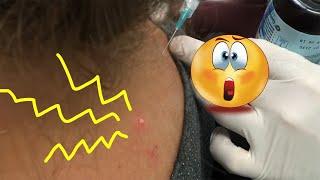 Neck Quickie Trigger Point Injections