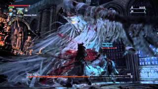 Vicar Amelia boss fight double visceral attack