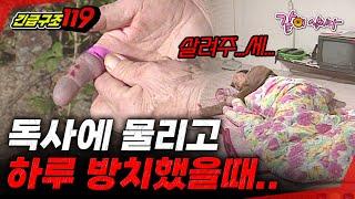 [긴급구조119] 독사에 물리고 하루 방치했을때 생기는 일.. | KBS 1995.11.14