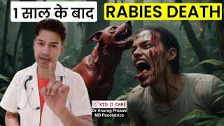 7 साल के बाद रेबीज (Rabies): Human Errors Leading to Prolonged Incubation Period by Dr Anurag Prasad