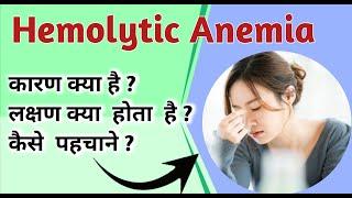 causes of hemolytic anemia