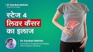 लिवर कैंसर स्टेज ४ का इलाज  |  Treatment for Stage 4 Liver Cancer | Dr  Sanket Mehta