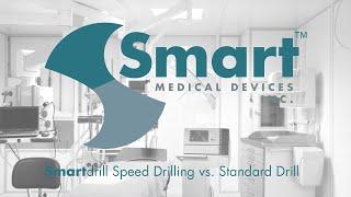 SMD Speed Drilling Comparison