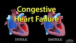 Congestive Heart Failure: Left-sided vs Right-sided, Systolic vs Diastolic, Animation.