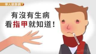 【華人健康網】健康小學堂 - 指甲容易斷裂，哪裡生病了？3點自我檢測