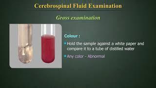 Cerebrospinal Fluid Examination (CSF)