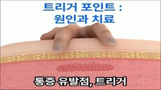 근골격계 트리거 포인트: 원인과 치료법 Musculoskeletal Trigger Points: Causes and Treatments