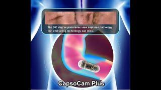 CapsoCam Plus VS End-view Capsule