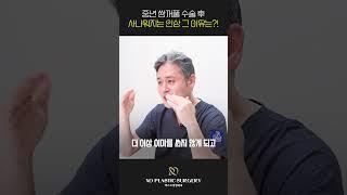 #중년눈성형 #상안검 받으면 사나워지나요?