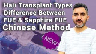 Hair Transplant Types | Difference Between FUE & Sapphire FUE | Chinese Method | Dr. Habib