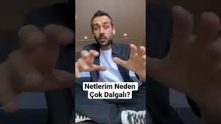 Netlerim Neden Çok Dalgalı?