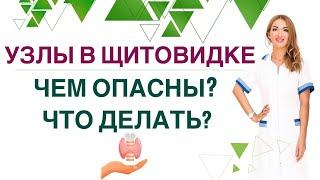 ️ ЩИТОВИДНАЯ ЖЕЛЕЗА. УЗЛЫ И КИСТЫ: ЧЕМ ОПАСНЫ ЧТО ДЕЛАТЬ Врач эндокринолог Ольга Павлова