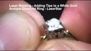 Laser Welding - Tipping an Antique Ring