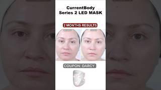 2-months Results | CurrentBody Series 2 LED MASK #ledlighttherapy #beforeandafter