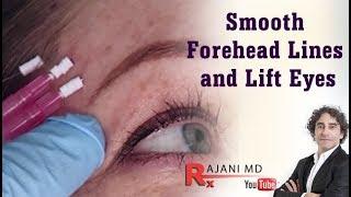 How to Smooth Forehead Lines and Lift Brows with PDO Threads Portland Oregon