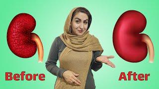 درمان کلیه دیابتی | میخوای مشکل کلیه هات حل بشه؟ این چندتا کار ساده رو انجام بده!