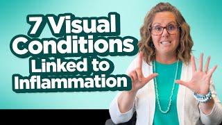 7 Visual Conditions Linked to Inflammation | Vision Therapy