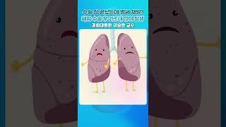 수술 잘 끝났는데 벌써 재발? 폐암 수술 후 2년 내 많이 발생