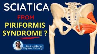 Piriformis Syndrome, Sciatica Symptoms & Back Pain