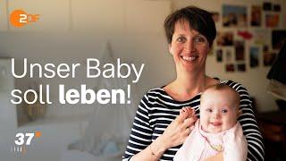 Aus Liebe: Diese Eltern entscheiden sich für ihr Baby mit Behinderung I Ganze Folge I 37 Grad