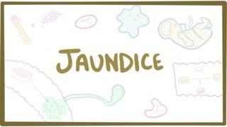 Jaundice - causes, treatment & pathology