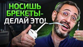 4 совета от стоматолога, как ухаживать за брекетами