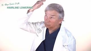 Dr. Toby Mayer Facial Feminization Surgery - Hairline Lowering