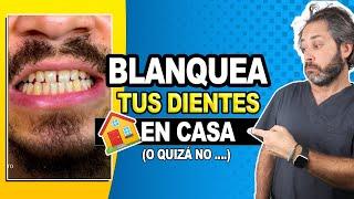  Si quieres saber como BLANQUEAR tus dientes AMARILLOS en  CASA  ESTE REMEDIO no tiene DESPERDICIO