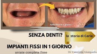 Un impianto dentale fisso realizzato in un solo giorno - Studio Dentistico Cannizzo