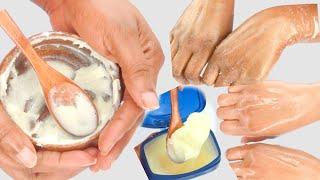 HOW TO EASILY GET SOFT, HEALTHY HANDS AT HOME, WRINKLE-FREE SMOOTH HANDS.