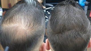 Magic Hair Fiber Haircut Suprise Transformation