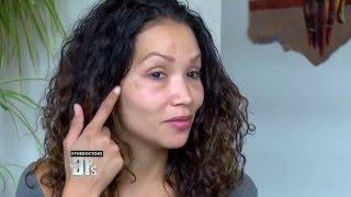 Actress Seeks Help for Under Eye Nightmare