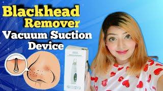 How To Use Blackhead Vacuum Suction Machine || blackhead pore vacuum | Does it Work???