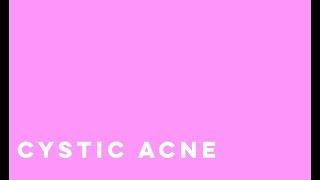 Photodynamic Therapy for Cystic Acne l Total Dermatology