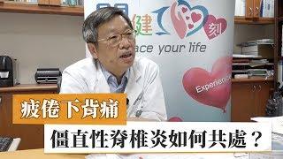 疲倦下背痛　如何與僵直性脊椎炎和平共處？