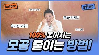 피부 좋아지고 시펑? % 좋아지는 커진 모공 줄이는 방법️ 대.공.개️