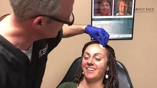 Botox Treatment Video