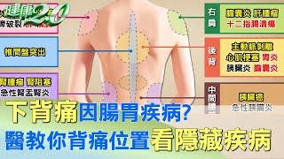 下背痛因腸胃疾病? 醫教你背痛位置看隱藏疾病 健康2.0