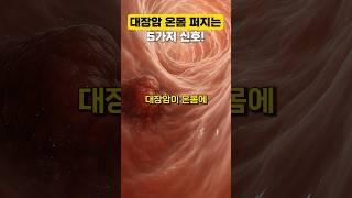 대장암 온몸에 퍼진다는 충격적 증상 5가지! #건강 #건강관리