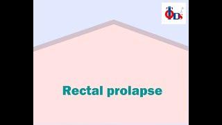 Rectal Prolapse | Dr Tulip JP Nagar