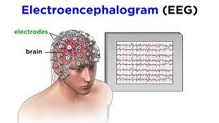 Research Methods of Biopsychology