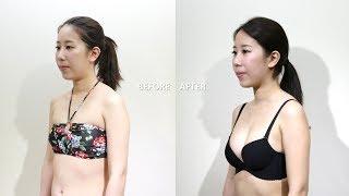 自體脂肪隆乳心得分享 訂製美胸成功駕馭性感衣著 | 淨妍醫美