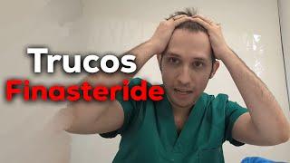 FINASTERIDE para RECUPERAR tu PELO : CONSEJOS de MÉDICO