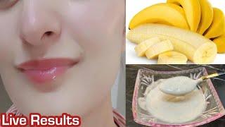 Banana Permanent Skin Whitening Face Mask / Get Forever Fair Spotless Glowing Skin 100%Results